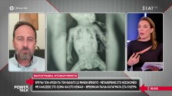 Έρευνα των Αρχών για τον θάνατο 2,5 μηνών βρέφους - Βρέθηκαν παλιά κατάγματα στα πλευρά 