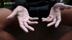  Κατάλευκα τα χέρια των παικτών από το κρύο και τη βροχή