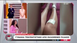Πεζοδρόμια - παγίδες: Γυναίκα τραυματίστηκε από ξηλωμένες πλάκες 